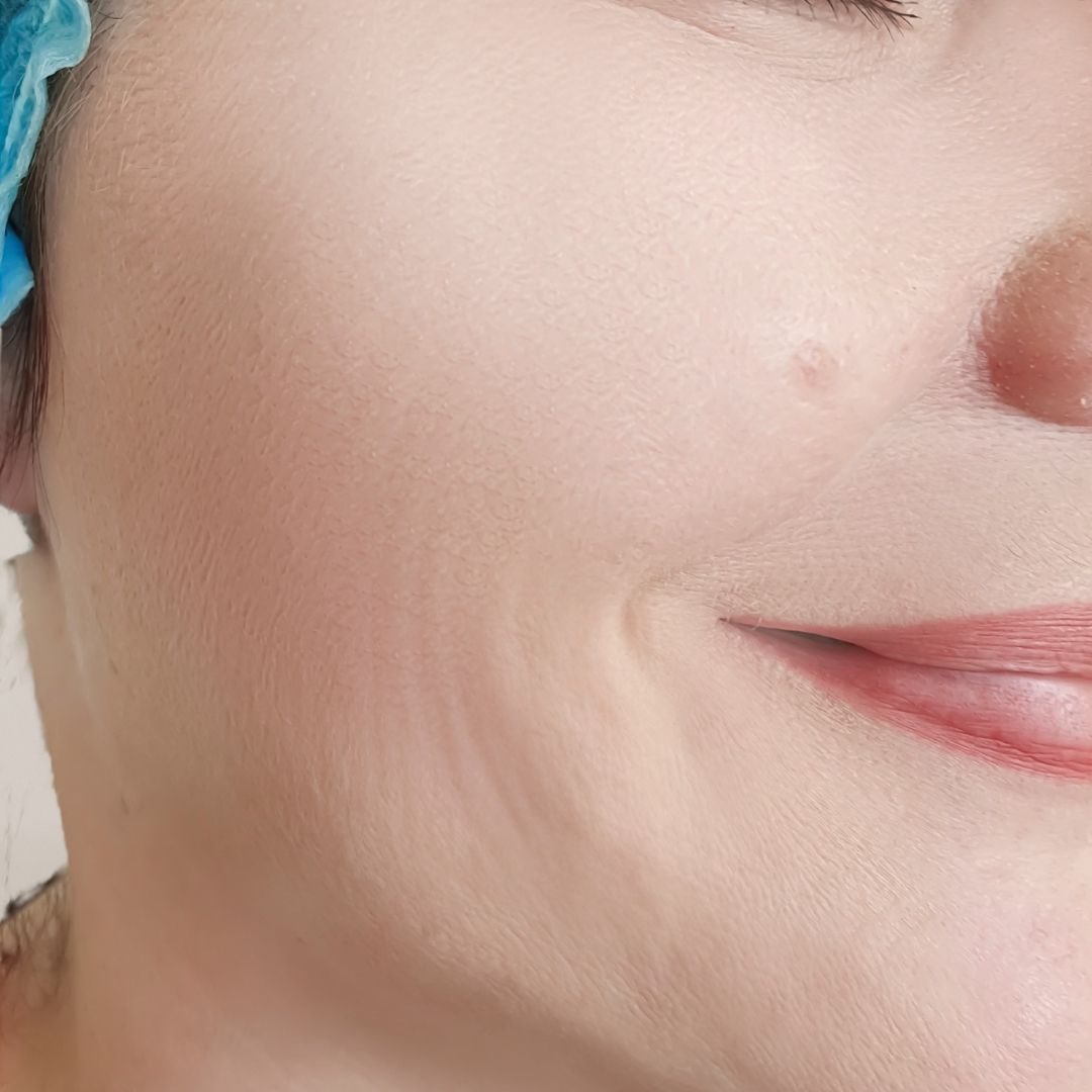 apres centre anti age