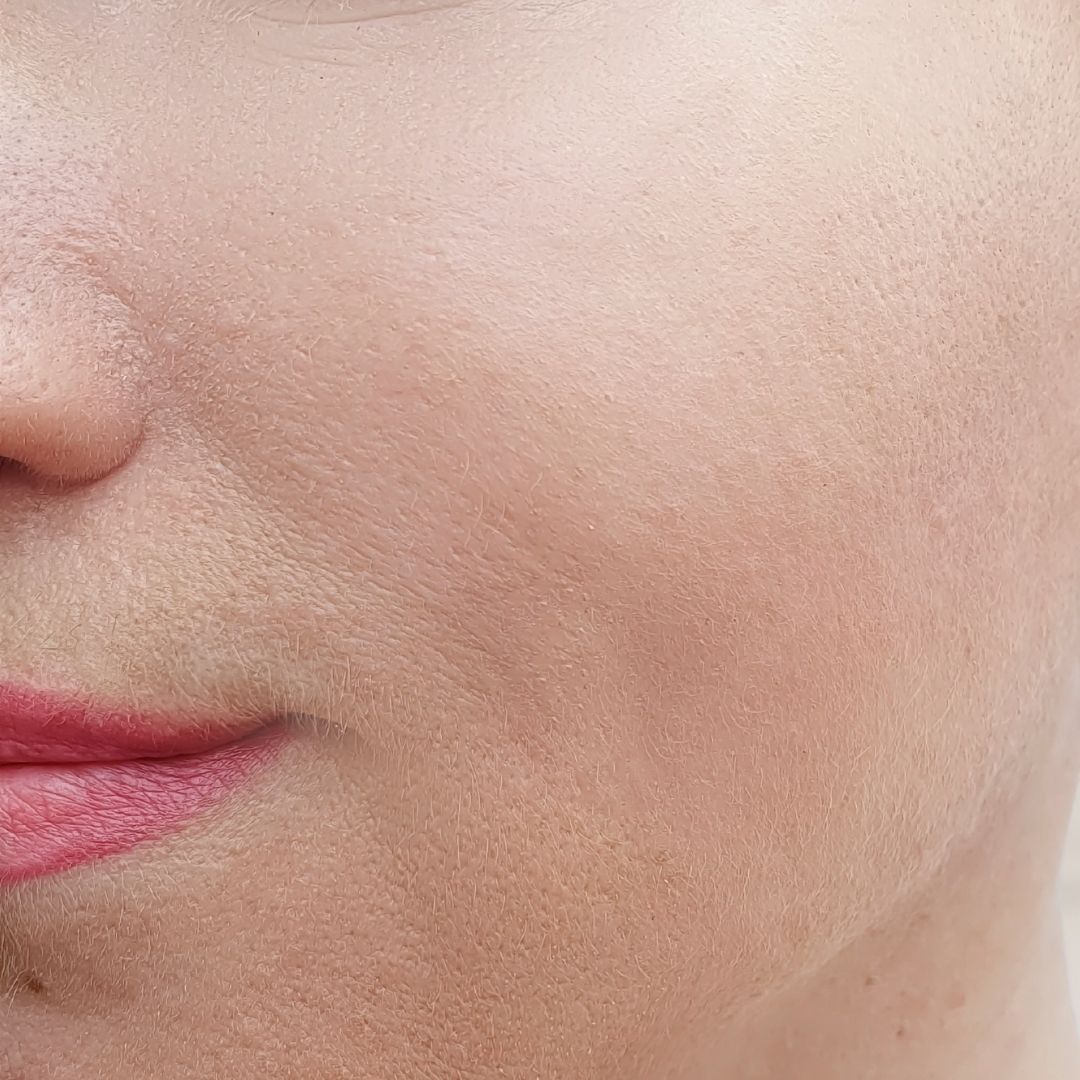 apres centre anti age (2)