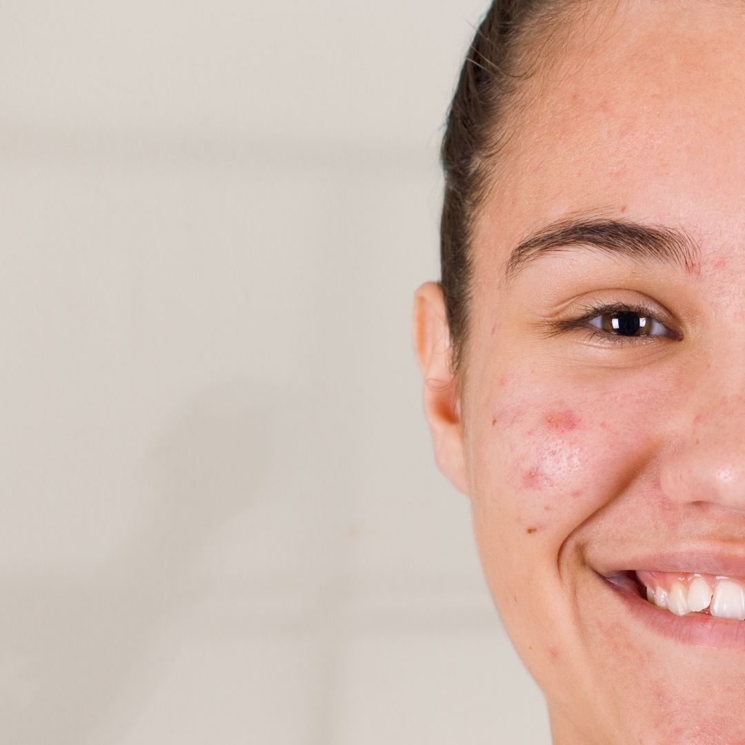 apres centre anti age (23)