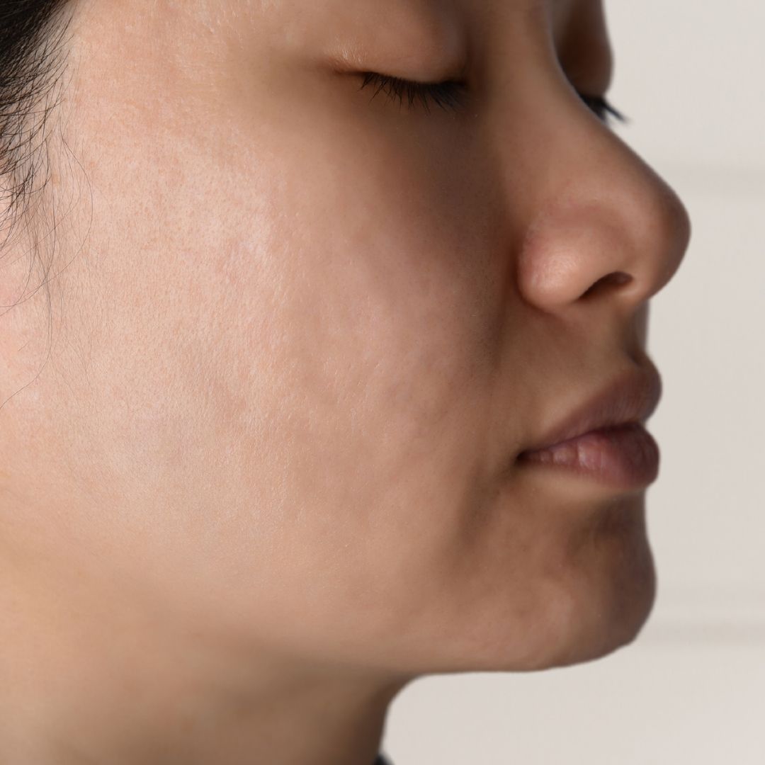 apres centre anti age (3)