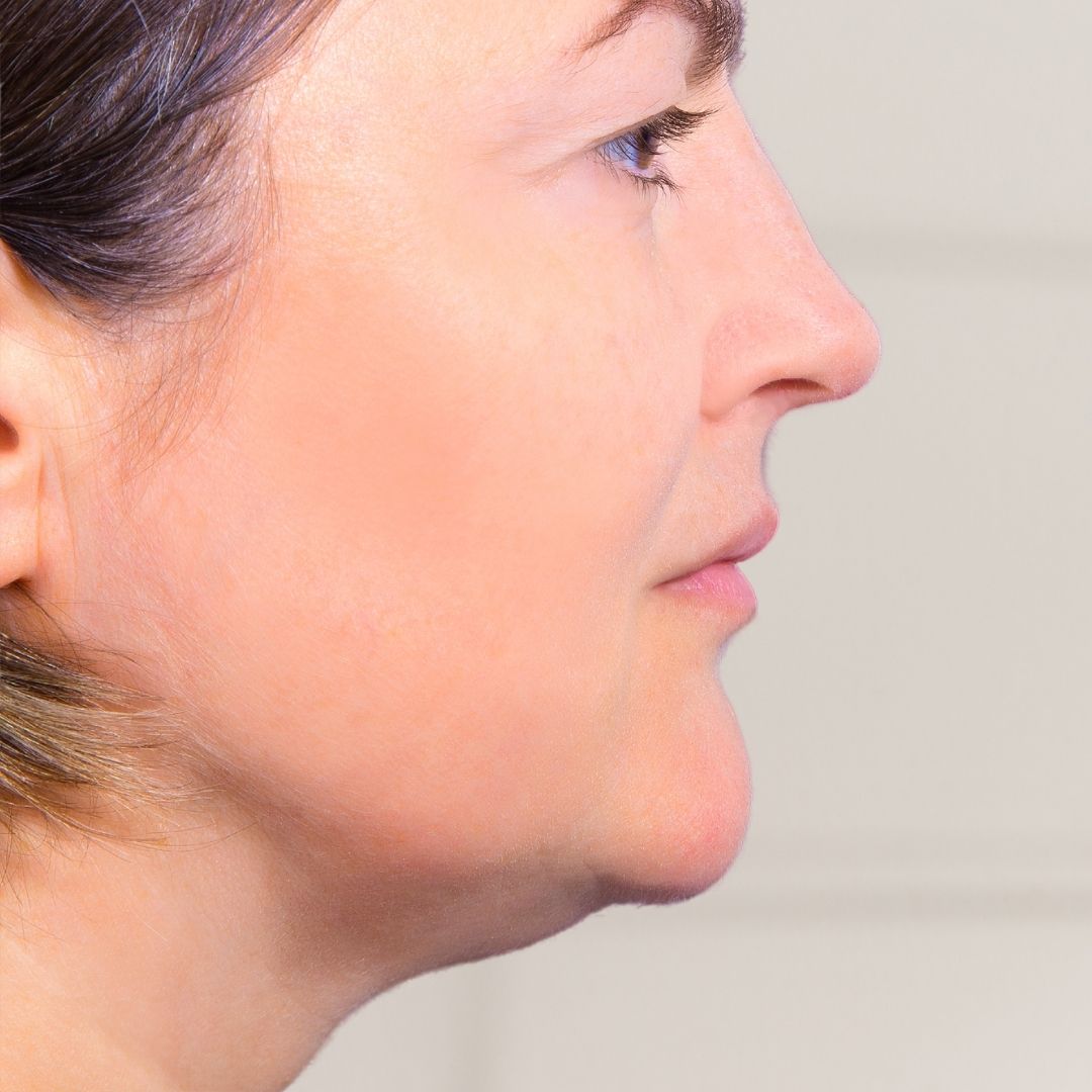 apres centre anti age (6)