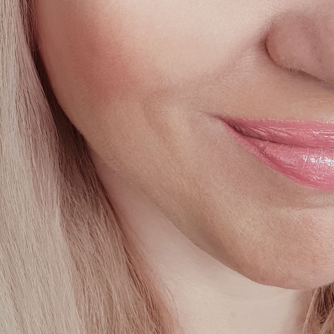 apres centre anti age (7)