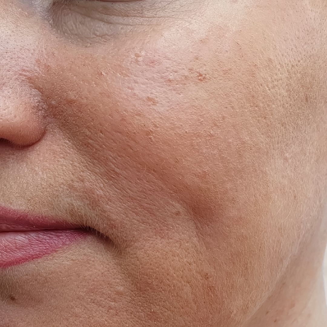 avant centre anti age (2)