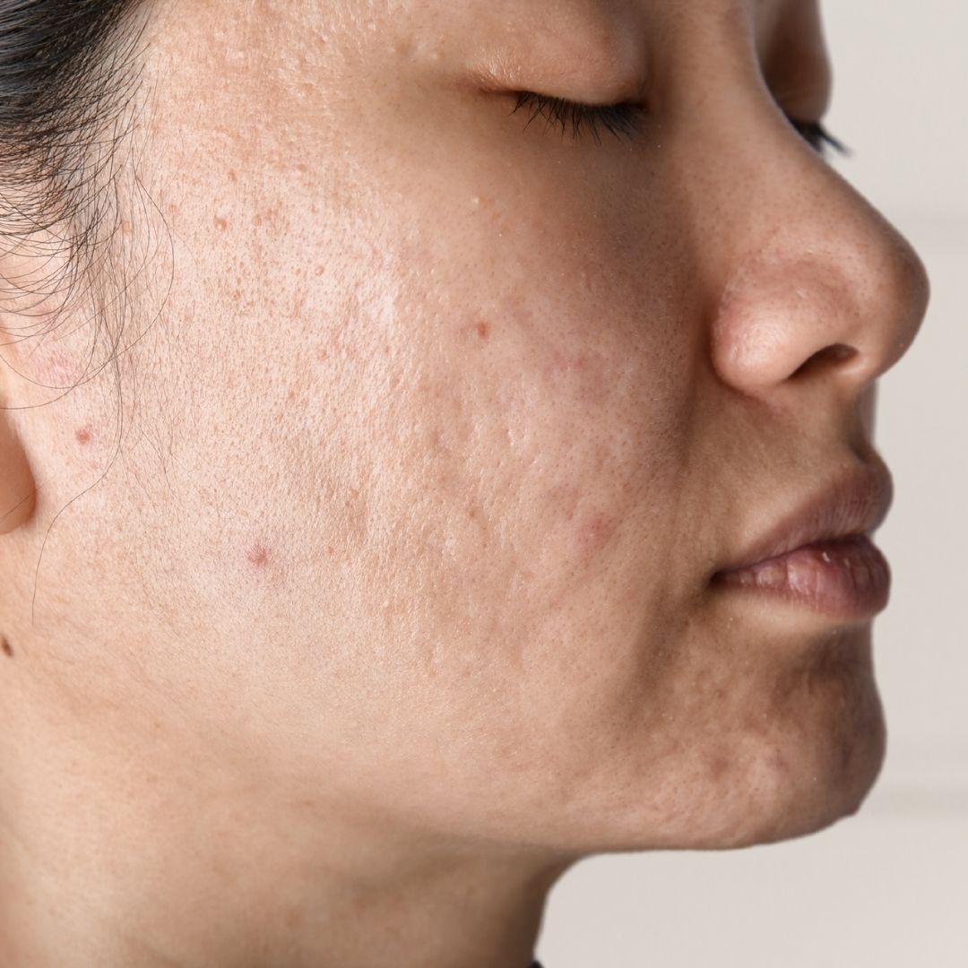 avant centre anti age (3)