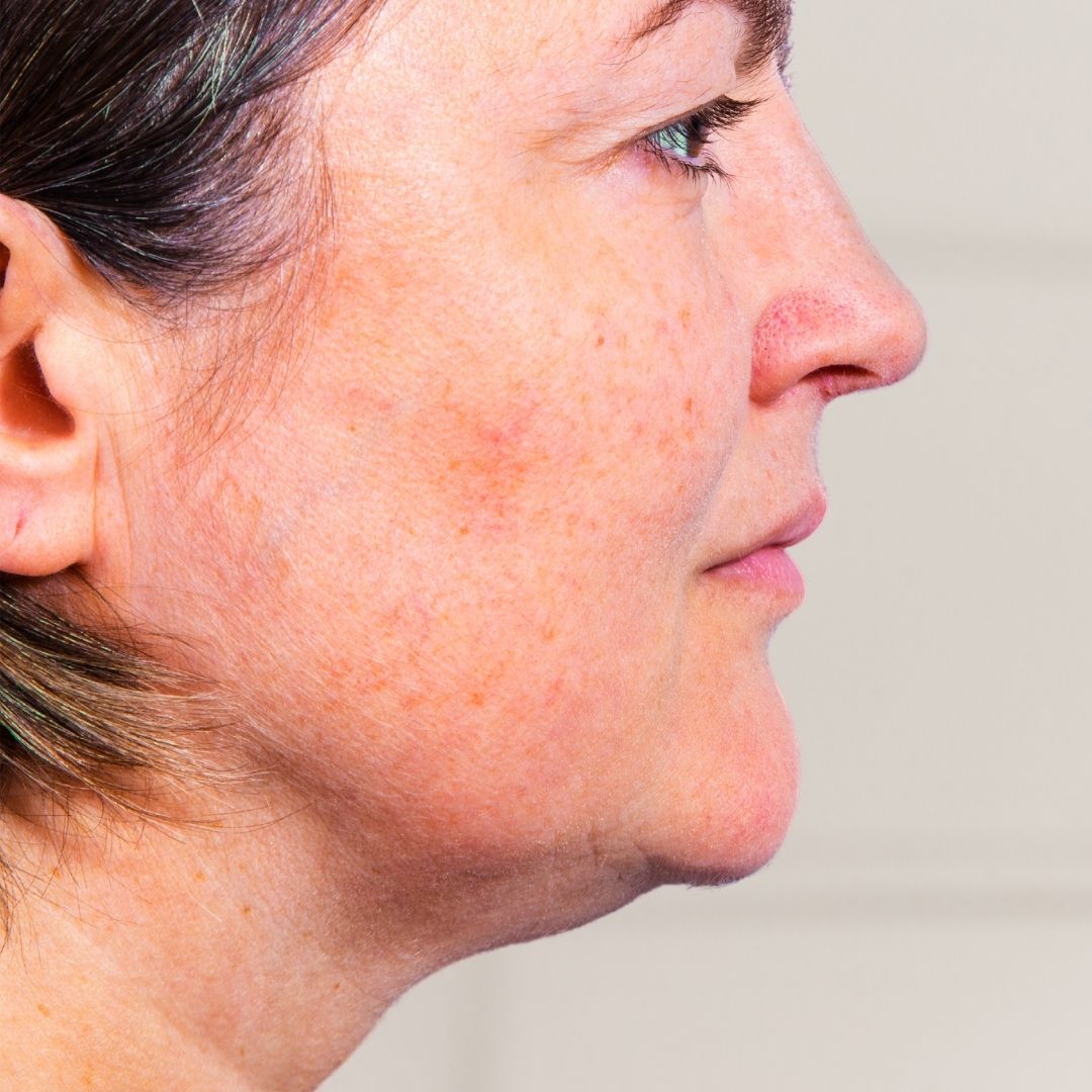 avant centre anti age (6)