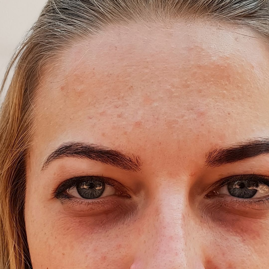 avant centre anti age (8)