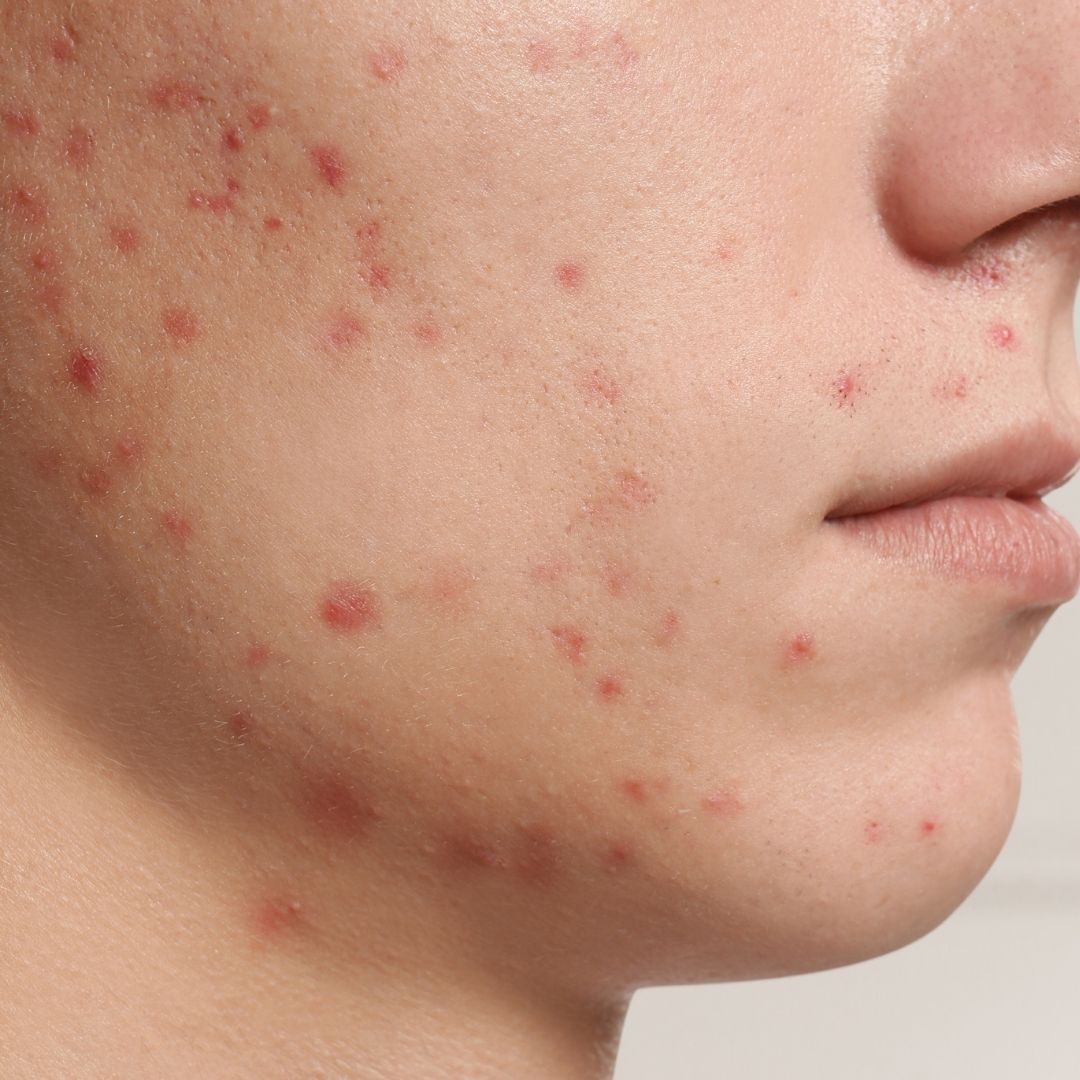 avant centre anti age (9)