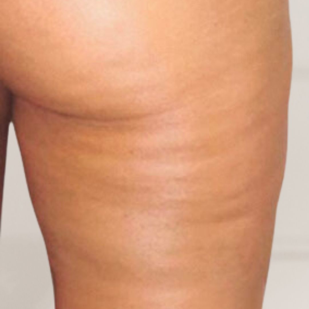 avant centre minceur (11)